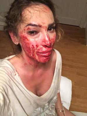 [VIDEO] Rutkowski ratuje „żony Konstancina”.  Ofiara przemocy Ewelina Ślotała zdecydowała się opowiedzieć o swoim dramacie