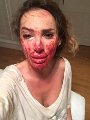 Nie żyje 35-letnia Ewelina Ślotała - autorka książek o kulisach życia w Konstancinie.  Krzysztof Rutkowski udzielił jej pomocy po brutalnym pobiciu w Hiszpanii